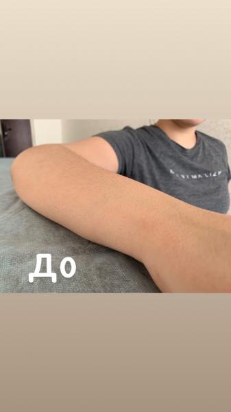 Восковая депиляция