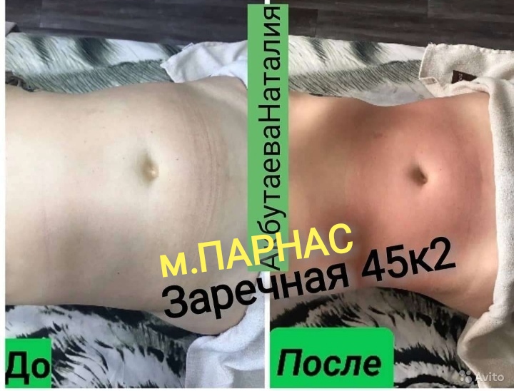 Массаж Парнас Заречная Массаж Парнас Заречная