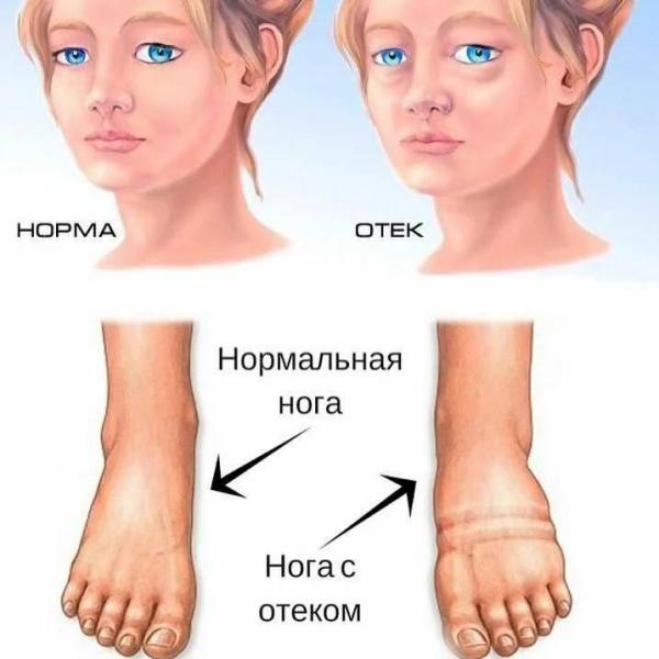 Красота и здоровье Красота и здоровье