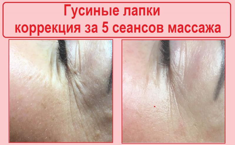 Косметический массаж лица Косметический массаж лица